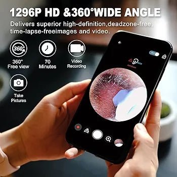 Earwax Removal Tool Kit with with HD Wifi Connection & 6 LED Lights Endoscope Tool Ear Cleaner Rechargeable portable Baby Children adults for IOS & Android (V1)