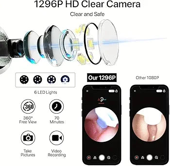 Earwax Removal Tool Kit with with HD Wifi Connection & 6 LED Lights Endoscope Tool Ear Cleaner Rechargeable portable Baby Children adults for IOS & Android (V1)